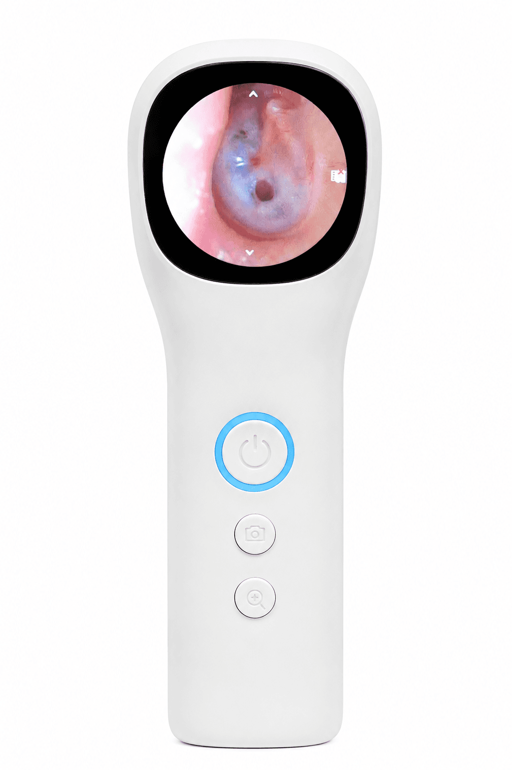 All In One Portable Digital Video Otoscope — view 1